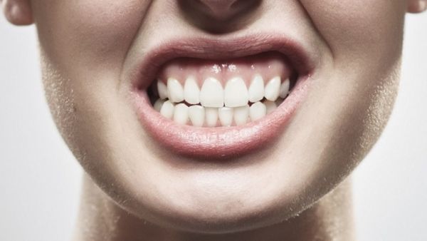 Dolor de cuello y mandíbula: la conexión ignorada entre estrés, pantalla y bruxismo